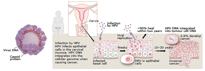 can hpv cause benign tumors)